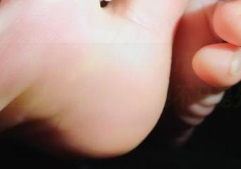 微密圈 – 直击心底的YuYu超甜丫“镂空”写真图包，所呈现的绝不只是外表。